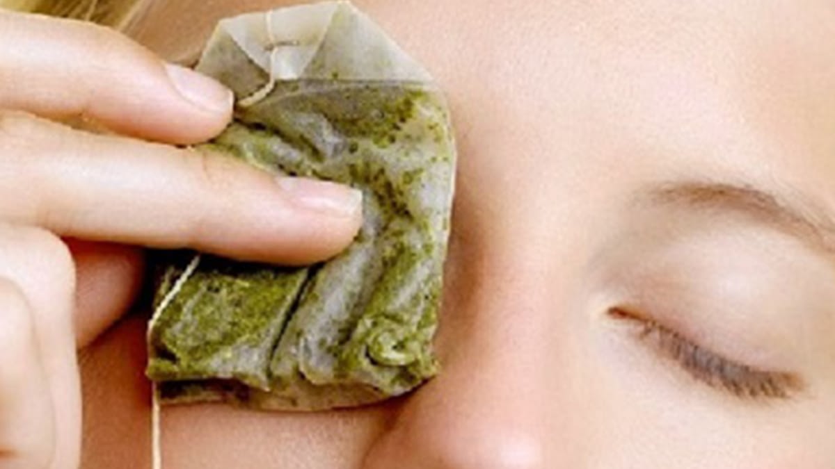 do-tea-bags-on-eyes-really-work-dark-circles-free