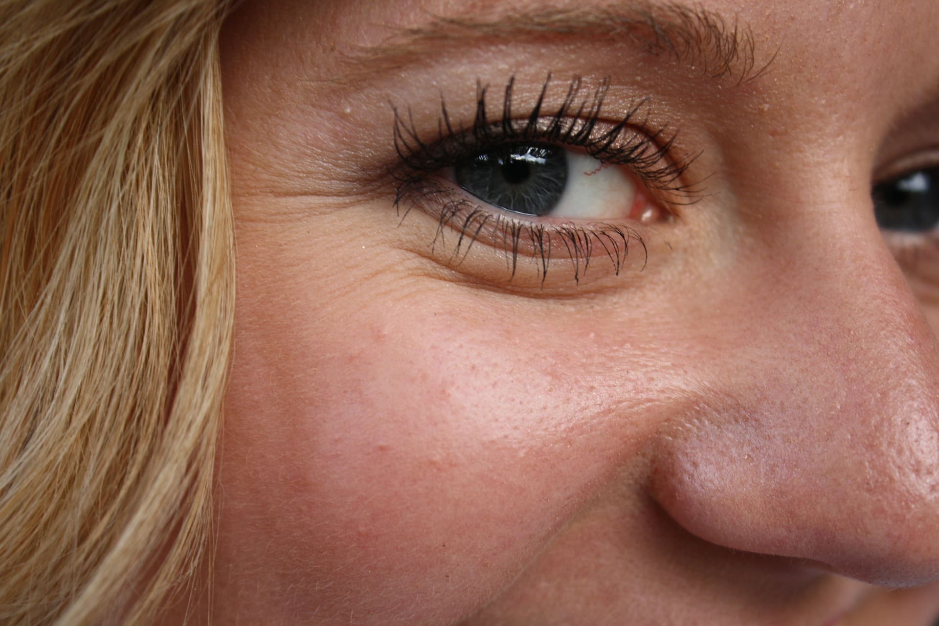 10 Best Home Remedies For Eye Wrinkles